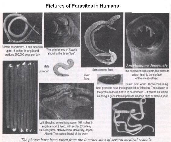 human parasites