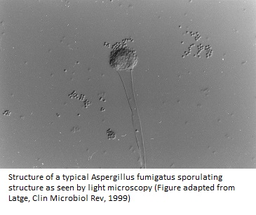 Aspergillus-fumigatus