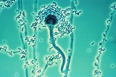 Aspergillus