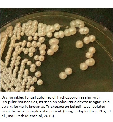 Trichosporon-spores-in-petry-dish