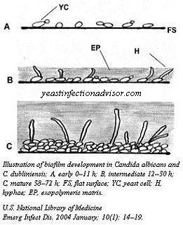 infection treatment skin yeast Fungi Structure Understanding Candida, the of Yeast, and