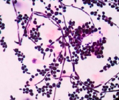 Budding-Yeast-Cells-With-Pseudohyphae