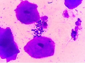 budding-yeast-with-pseudohyphae