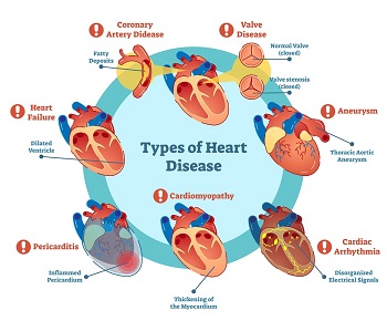 Types-of-Heart-Disease-Chart