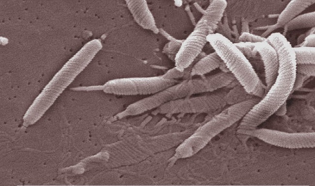 Helicobacter-pylori-bacteria